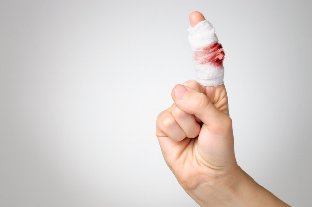 동창회에서의 싸움으로 손가락 절단 발생, 적절한 응급처치 방법은?, 시보드 블로그