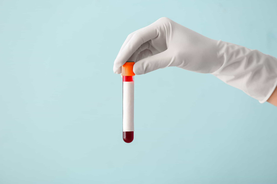 혈액형과 우리 건강에는 어떤 관계가 있을까?, 시보드 블로그