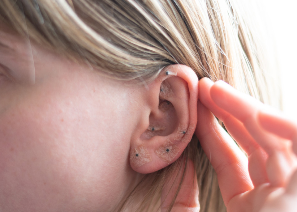 귀 지압술은 무엇이며 어떻게 작용하나?, 시보드 블로그
