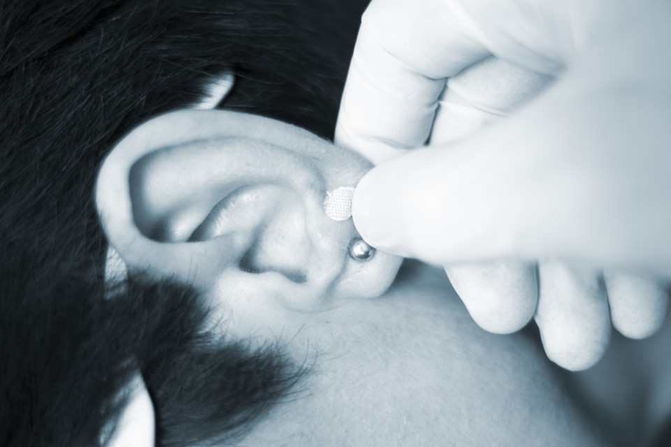 귀 지압술은 무엇이며 어떻게 작용하나?, 시보드 블로그