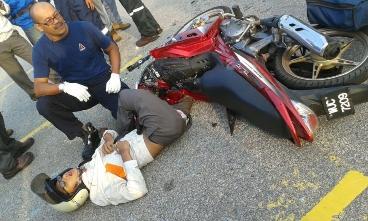 오토바이 사고로 다리가 이상한 방향으로 굽어버렸다.